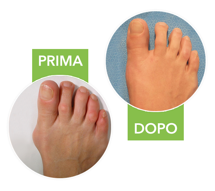 FootFix